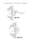 SPINAL DISC ANNULUS RECONSTRUCTION METHOD AND SPINAL DISC ANNULUS STENT diagram and image