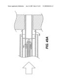 SPINAL DISC ANNULUS RECONSTRUCTION METHOD AND SPINAL DISC ANNULUS STENT diagram and image