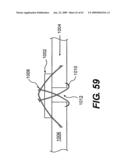 SPINAL DISC ANNULUS RECONSTRUCTION METHOD AND SPINAL DISC ANNULUS STENT diagram and image