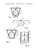 Method and Device for Internal Refurbishment of Corroded Hollow Sections diagram and image