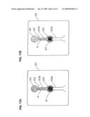 Method and device for applying adhesive agent to coating elastic string-like material diagram and image