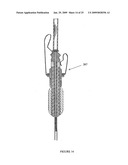 DIAPHONIC ACOUSTIC TRANSDUCTION COUPLER AND EAR BUD diagram and image