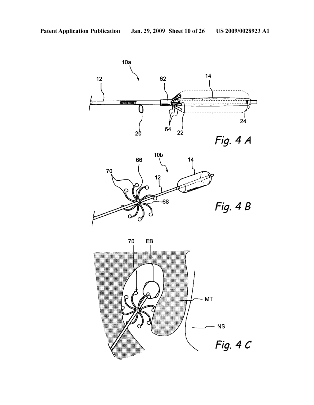 Implantable Devices and Methods for Treating Sinusitis and Other Disorders - diagram, schematic, and image 11