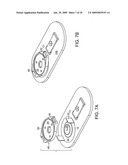 CID retention device for Li-ion cell diagram and image