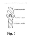 DENTAL IMPLANT AND METHOD FOR MANUFACTURING DENTAL IMPLANT diagram and image