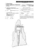 COMPONENTS FOR PERMANENT REMOVABLE AND ADJUSTABLE DENTURES AND BRIDGES diagram and image