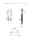 COMPONENTS FOR PERMANENT REMOVABLE AND ADJUSTABLE DENTURES AND BRIDGES diagram and image