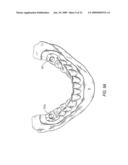 COMPONENTS FOR PERMANENT REMOVABLE AND ADJUSTABLE DENTURES AND BRIDGES diagram and image