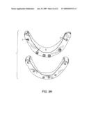 COMPONENTS FOR PERMANENT REMOVABLE AND ADJUSTABLE DENTURES AND BRIDGES diagram and image