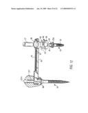 COMPONENTS FOR PERMANENT REMOVABLE AND ADJUSTABLE DENTURES AND BRIDGES diagram and image