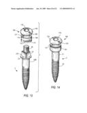 COMPONENTS FOR PERMANENT REMOVABLE AND ADJUSTABLE DENTURES AND BRIDGES diagram and image