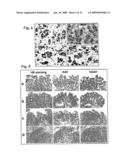 NEOPLASM-SPECIFIC POLYPEPTIDES AND THEIR USES diagram and image