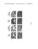 NEOPLASM-SPECIFIC POLYPEPTIDES AND THEIR USES diagram and image