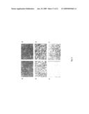 NEOPLASM-SPECIFIC POLYPEPTIDES AND THEIR USES diagram and image