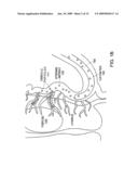 POROUS POLYMERIC PARTICLE COMPRISING POLYVINYL ALCOHOL AND HAVING INTERIOR TO SURFACE POROSITY-GRADIENT diagram and image