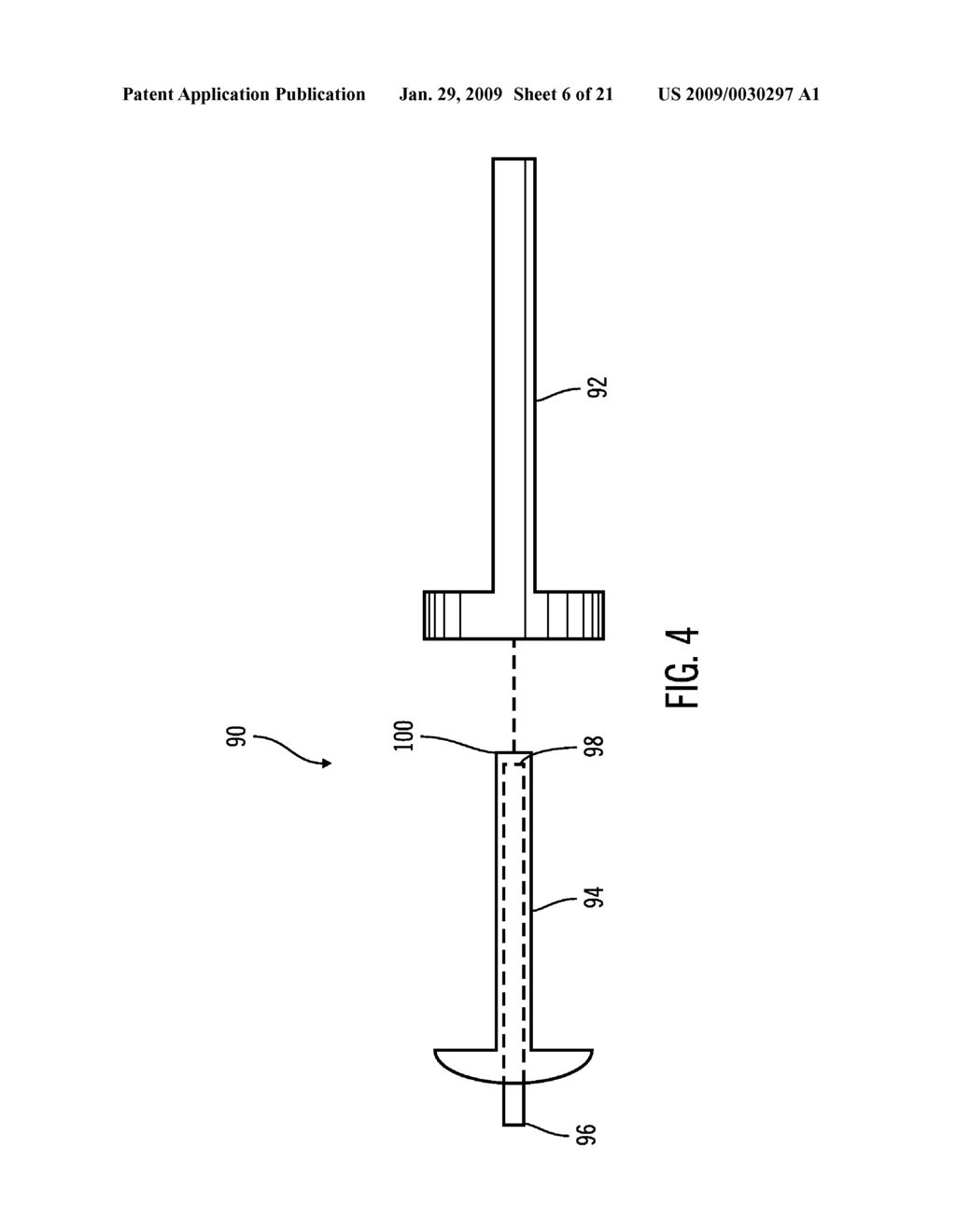 IMPLANTABLE SENSOR METHOD AND SYSTEM - diagram, schematic, and image 07