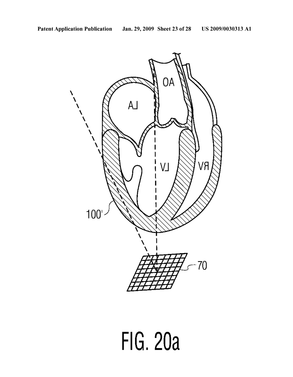 Three Dimensional Diagnostic Ultrasonic Image Display - diagram, schematic, and image 24