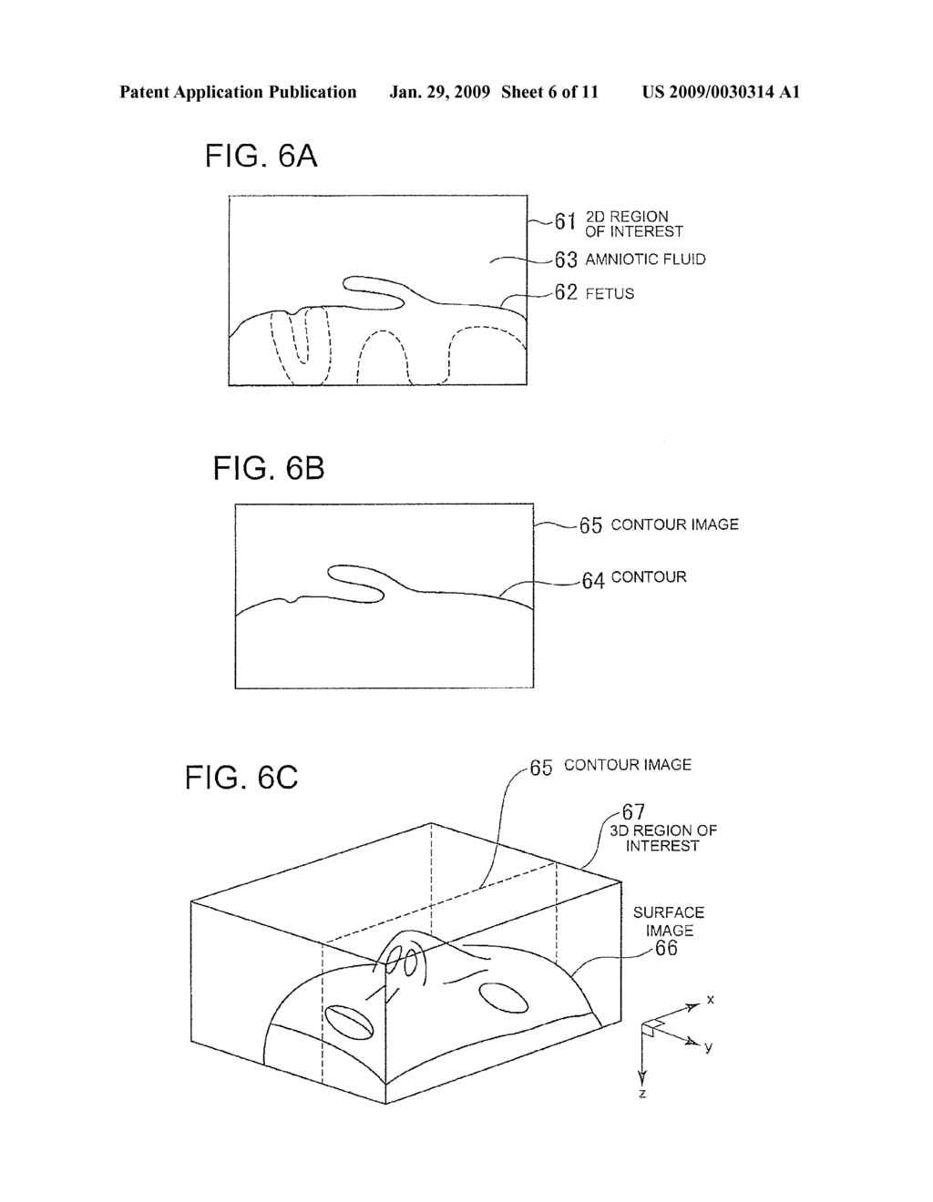 ULTRASONIC IMAGING APPARATUS AND IMAGE PROCESSING APPARATUS - diagram, schematic, and image 07