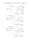 ULTRASONIC IMAGING APPARATUS AND IMAGE PROCESSING APPARATUS diagram and image