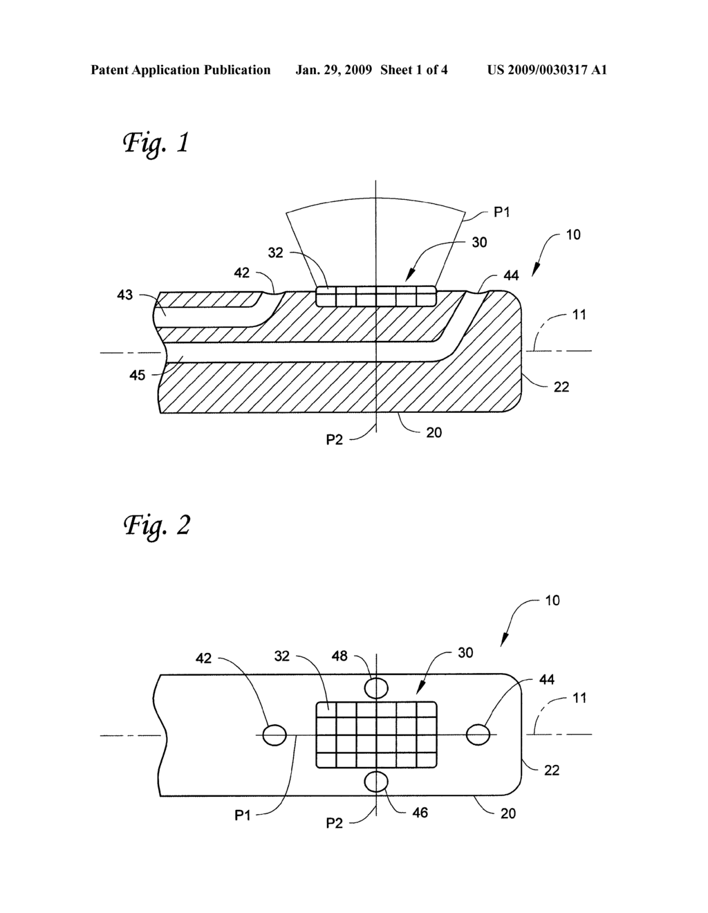 ULTRASONIC IMAGING DEVICES, SYSTEMS, AND METHODS - diagram, schematic, and image 02