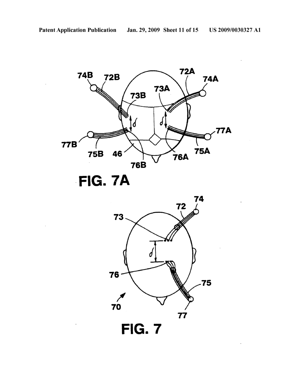 Optical coupler for in vivo examination of biological tissue - diagram, schematic, and image 12