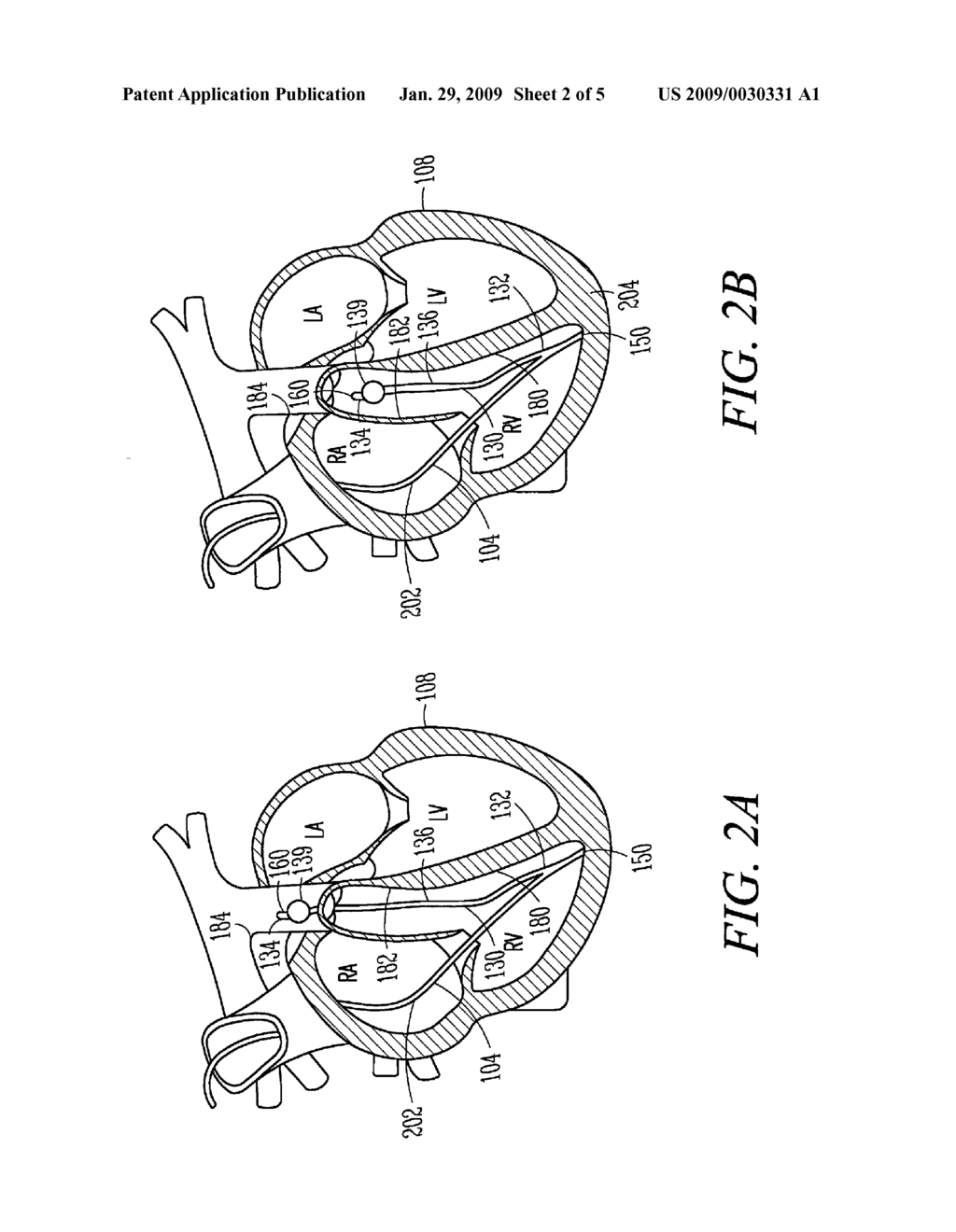 LEAD ASSEMBLY HAVING A TETHERED SENSOR AND METHODS RELATED THERETO - diagram, schematic, and image 03