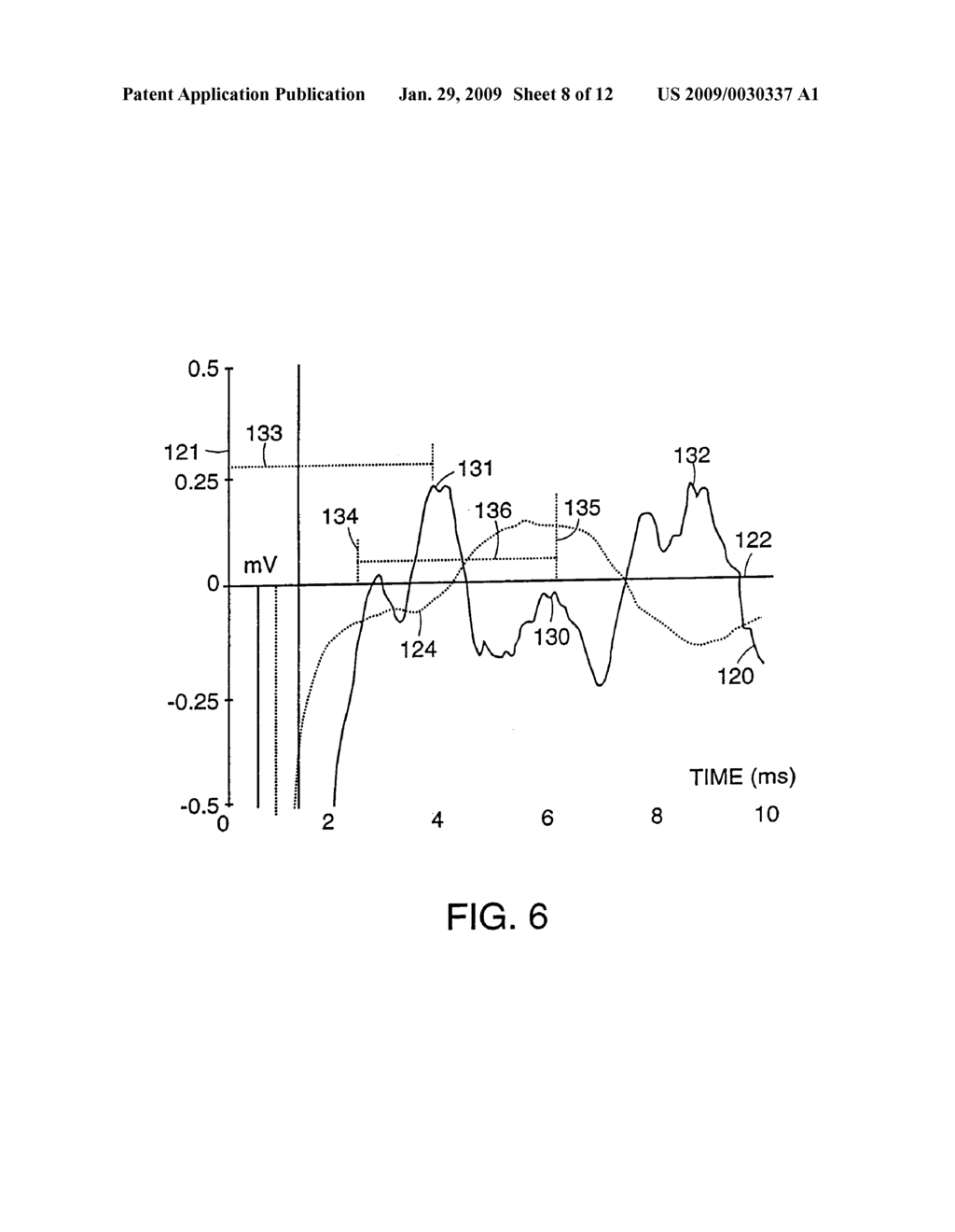 Methods for the assessment of neuromuscular function by F-wave latency - diagram, schematic, and image 09