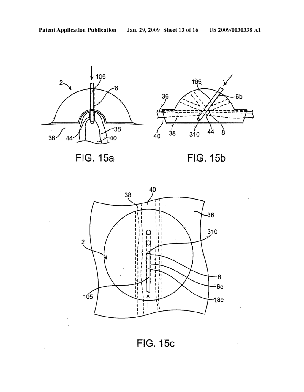 ACCESS GUIDE AND METHODS OF USING THE SAME - diagram, schematic, and image 14