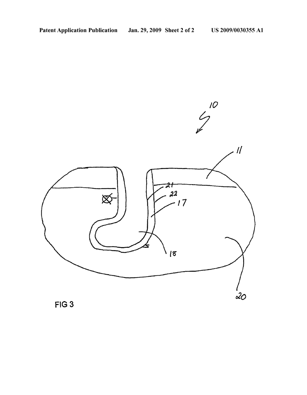 Hydrotherapy Apparatus for a Lower Extremity - diagram, schematic, and image 03