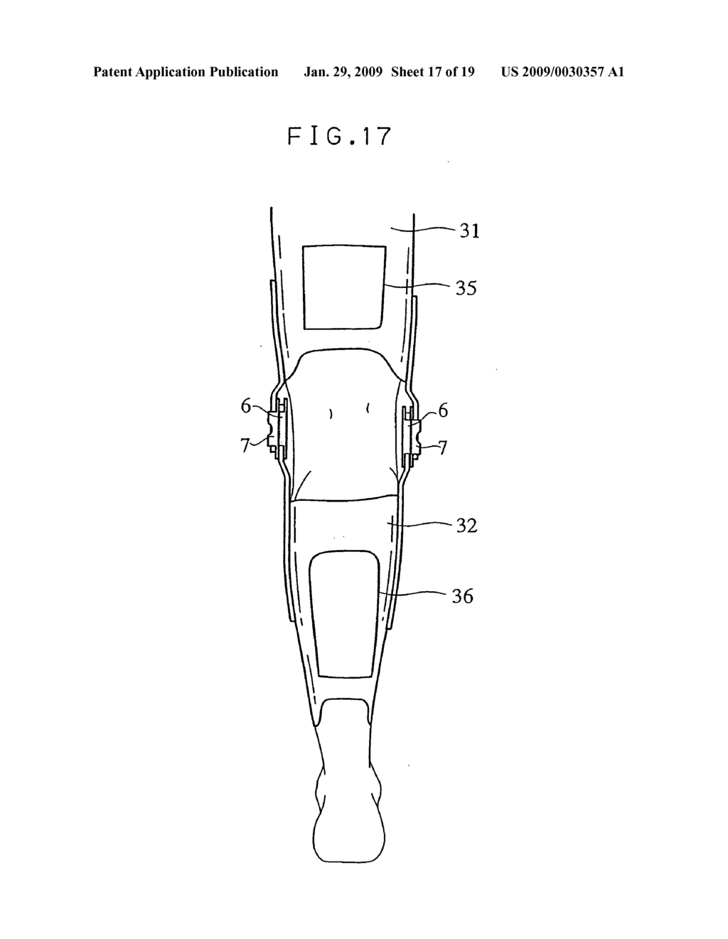 Rotary joint of articulation prosthetic implement having rotating load setting means, articulation prosthetic implement using the rotary joint and method of making articulation
prosthetic implement - diagram, schematic, and image 18