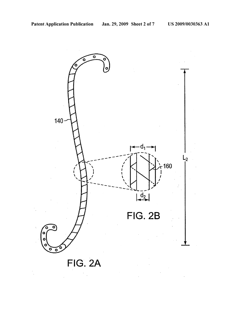 LINEARLY EXPANDABLE URETERAL STENT - diagram, schematic, and image 03