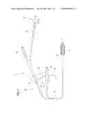 BALLOON CATHETER diagram and image