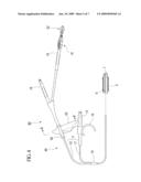 BALLOON CATHETER diagram and image