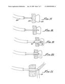 Method and Apparatus for Performing Needle Guided Interventions diagram and image