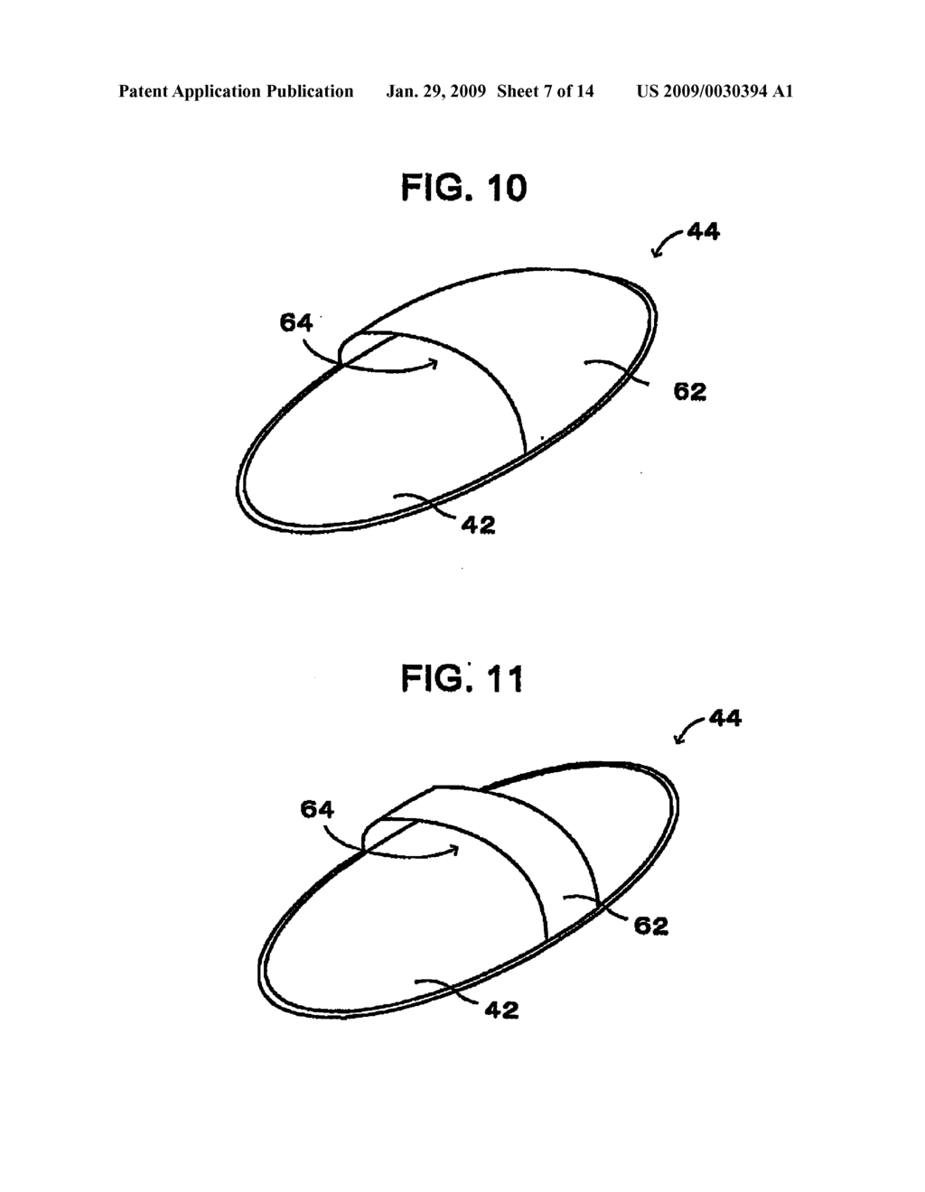 INTERLABIAL PAD AND PACKAGE THEREOF - diagram, schematic, and image 08