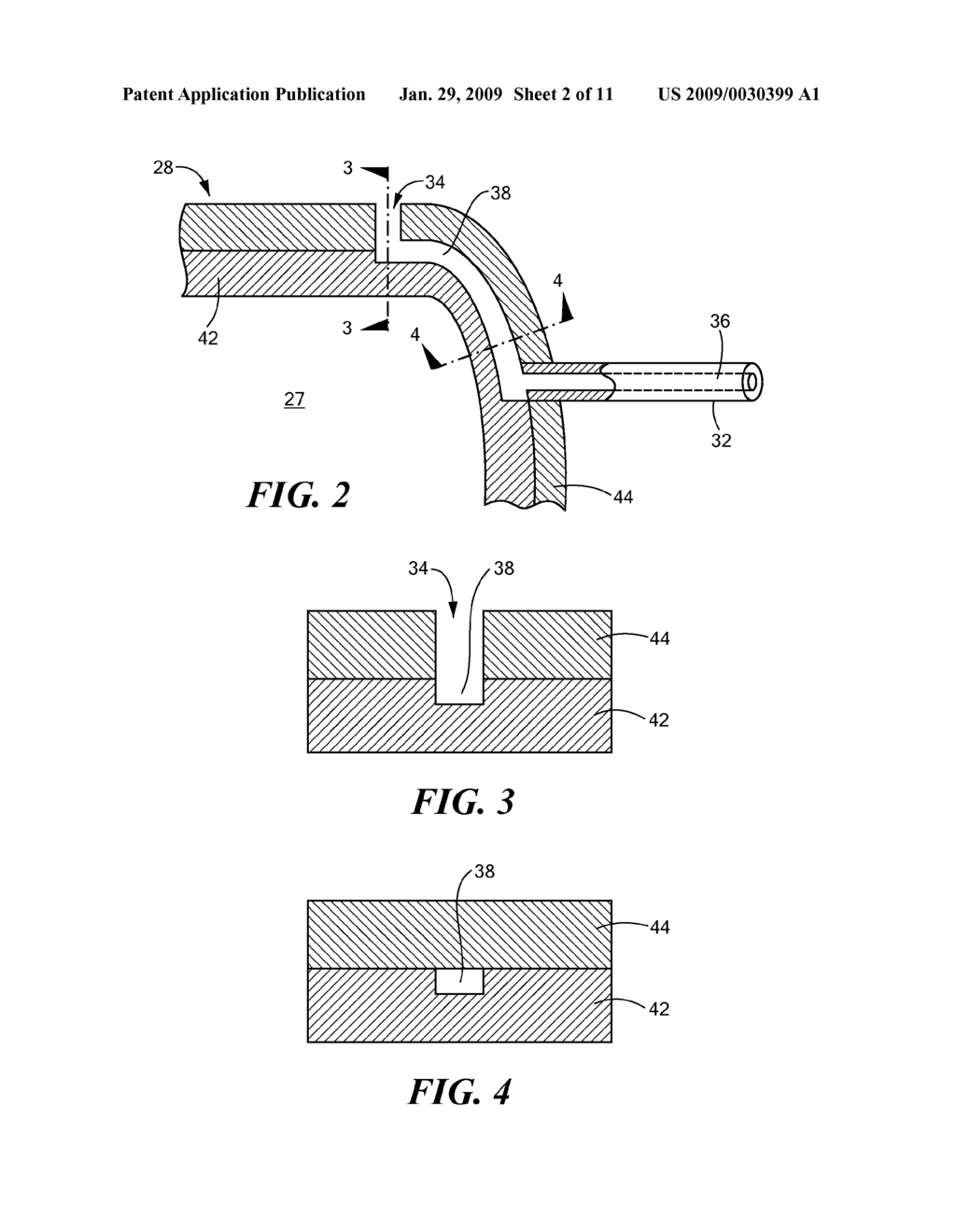 Drug Delivery Device and Method - diagram, schematic, and image 03