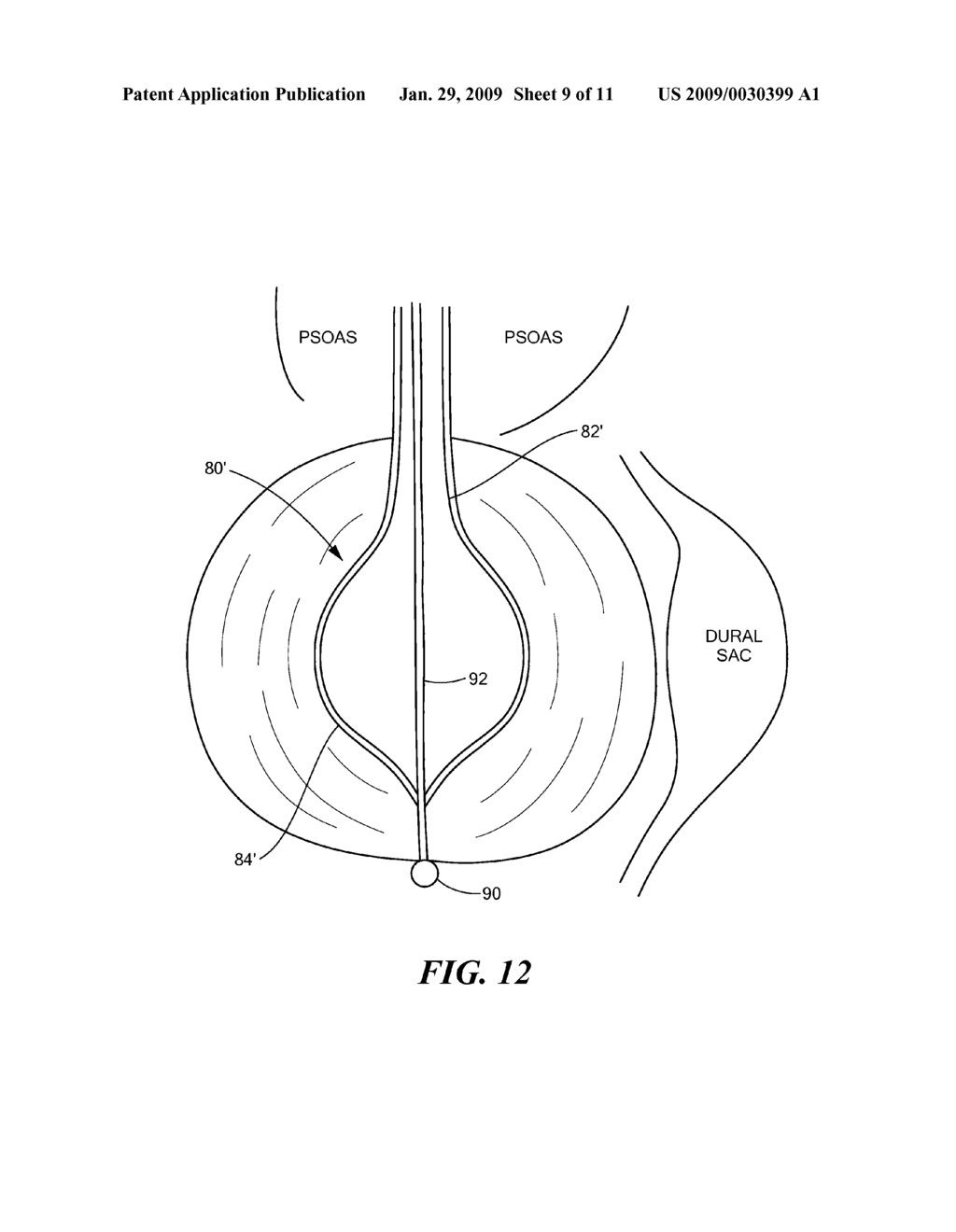 Drug Delivery Device and Method - diagram, schematic, and image 10