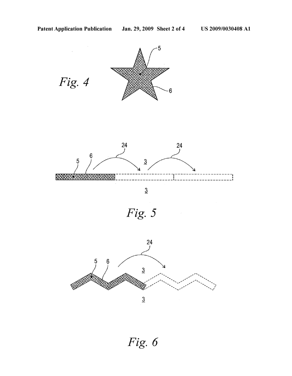 Laser System for Medical Removal of Body Tissue - diagram, schematic, and image 03