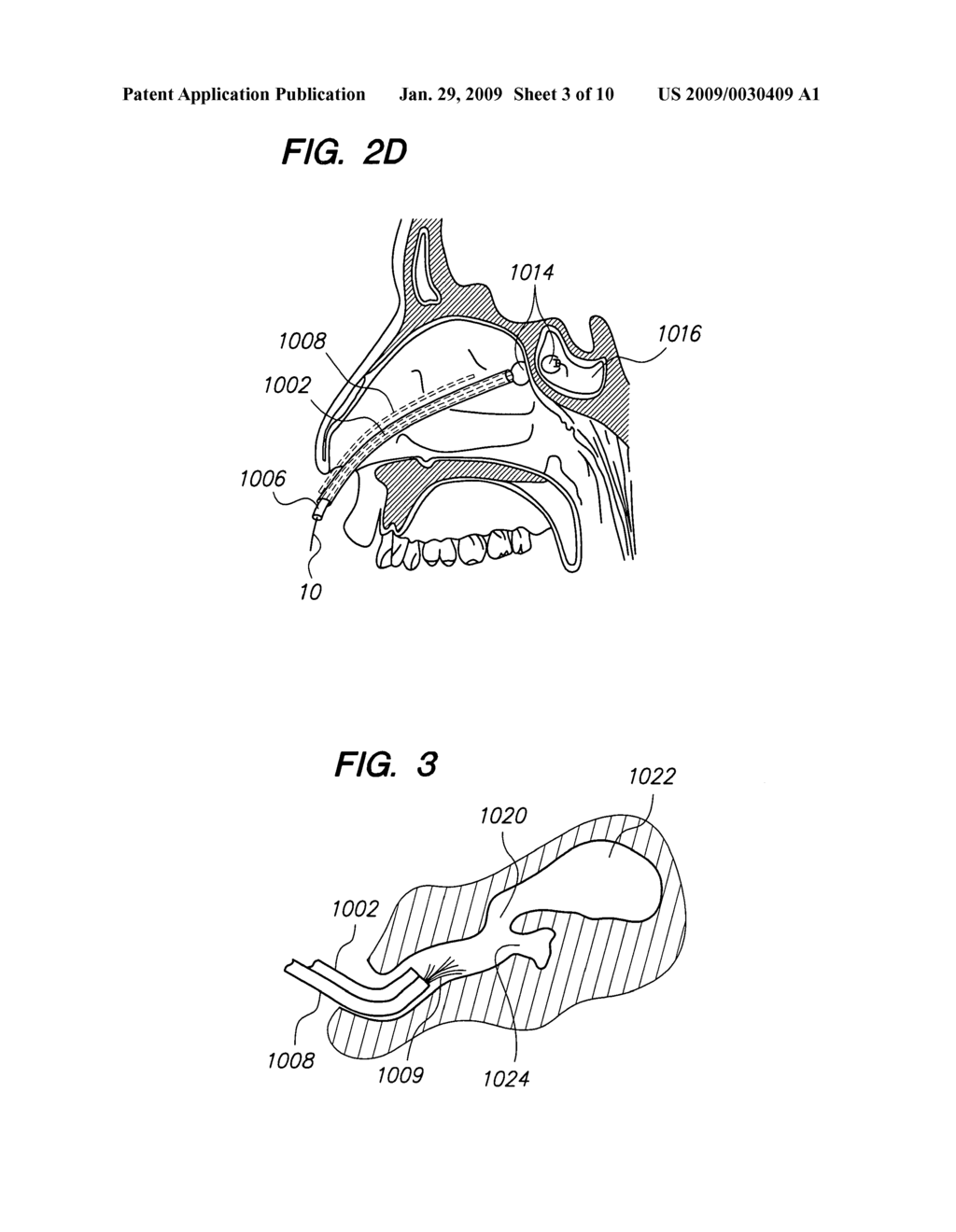 Methods and devices for facilitating visualization in a surgical environment - diagram, schematic, and image 04