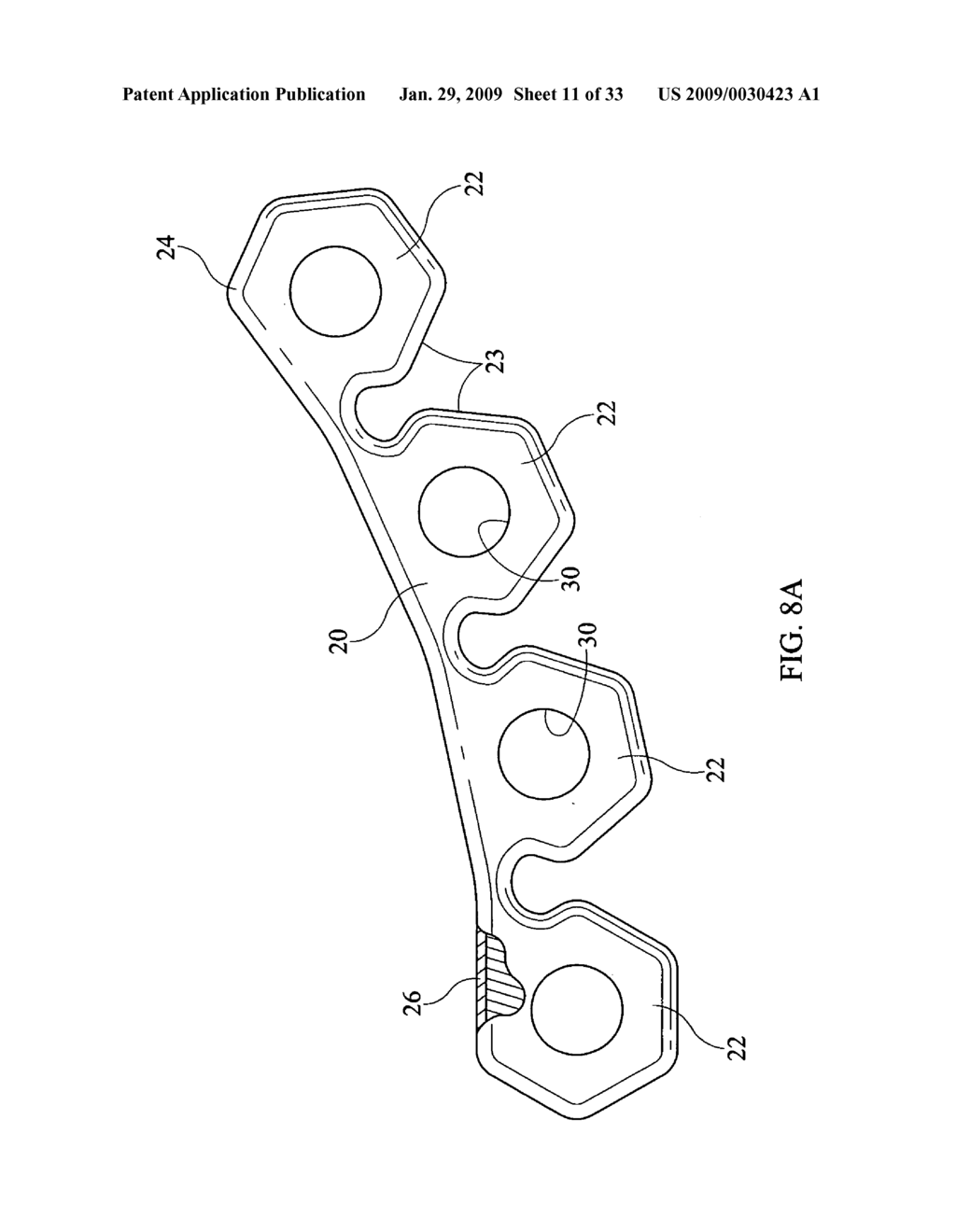 Inter-Body Implantation System and Method - diagram, schematic, and image 12