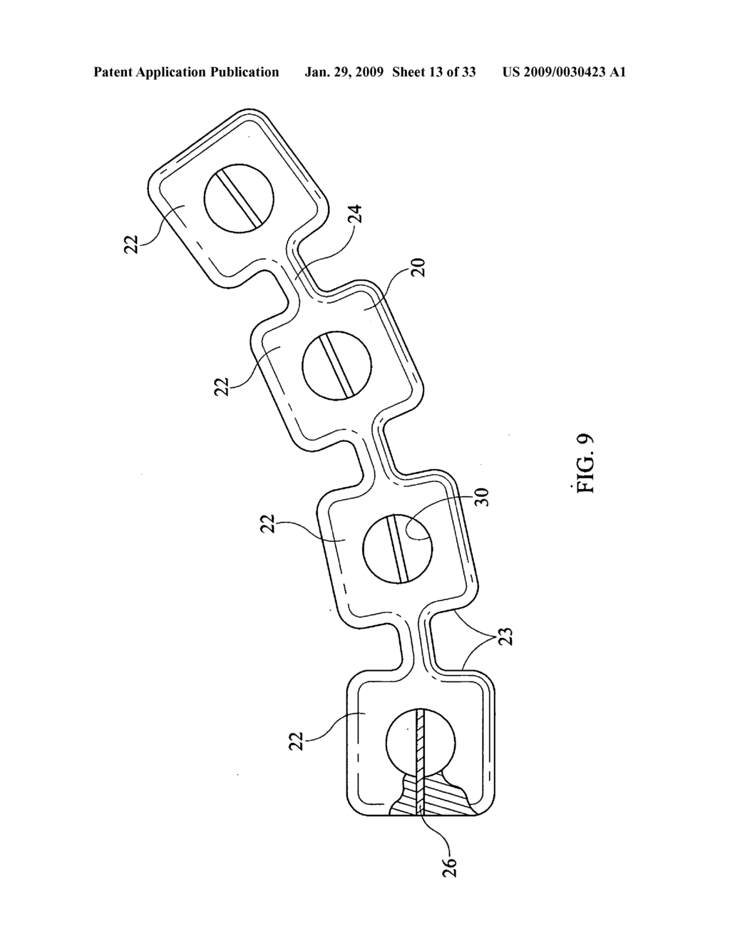 Inter-Body Implantation System and Method - diagram, schematic, and image 14