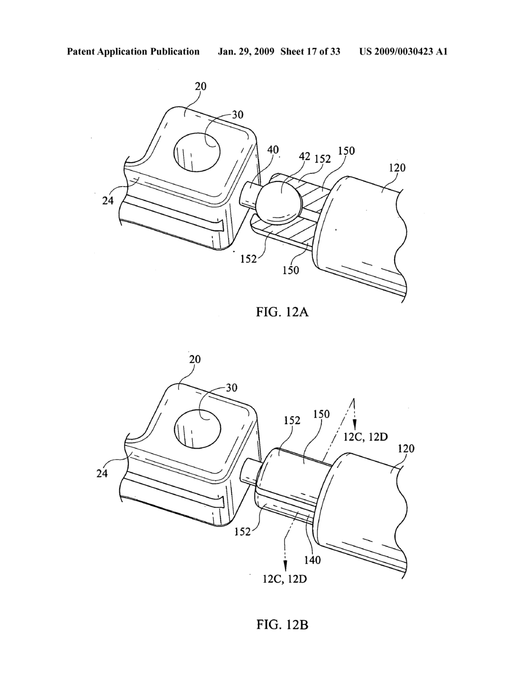 Inter-Body Implantation System and Method - diagram, schematic, and image 18