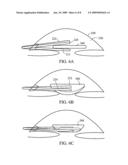 Surgical device for folding objects and methods of using the same diagram and image