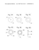 Circular Stapler Buttress diagram and image