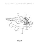 SPINAL FACET IMPLANT WITH SPHERICAL IMPLANT APPOSITION SURFACE AND BONE BED AND METHODS OF USE diagram and image