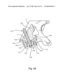 SPINAL FACET IMPLANT WITH SPHERICAL IMPLANT APPOSITION SURFACE AND BONE BED AND METHODS OF USE diagram and image