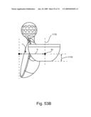 SPINAL FACET IMPLANT WITH SPHERICAL IMPLANT APPOSITION SURFACE AND BONE BED AND METHODS OF USE diagram and image