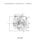 SPINAL FACET IMPLANT WITH SPHERICAL IMPLANT APPOSITION SURFACE AND BONE BED AND METHODS OF USE diagram and image