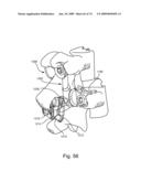 SPINAL FACET IMPLANT WITH SPHERICAL IMPLANT APPOSITION SURFACE AND BONE BED AND METHODS OF USE diagram and image