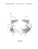 SPINAL FACET IMPLANT WITH SPHERICAL IMPLANT APPOSITION SURFACE AND BONE BED AND METHODS OF USE diagram and image